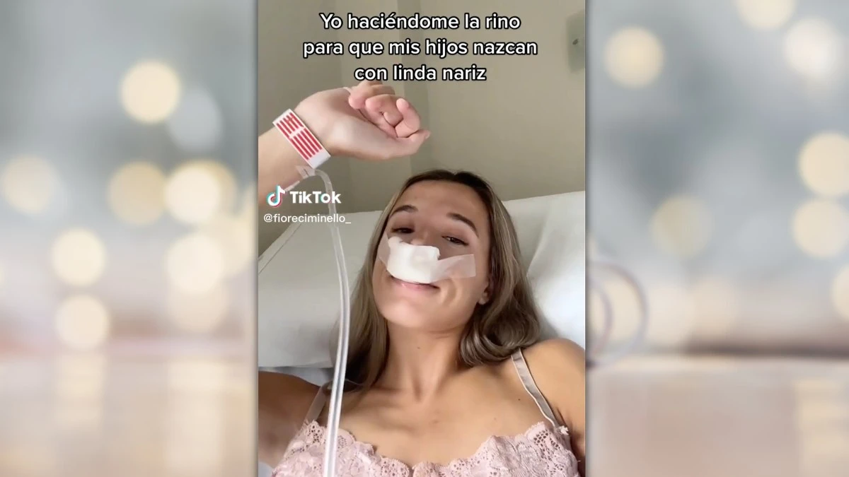 Influencerka przeszła operację nosa, żeby jej dzieci miały ładny nos